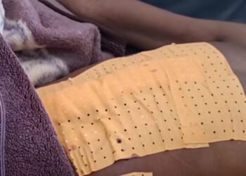 Labé : un homme grièvement blessé après avoir été poignardé au ventre par son épouse